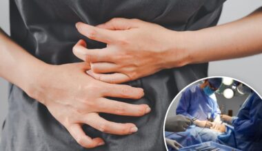 Doctor sews patient's organs together, creating 'closed loop' for poop