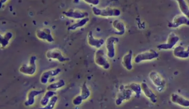 Central NC teen critically ill with rare amoeba infection