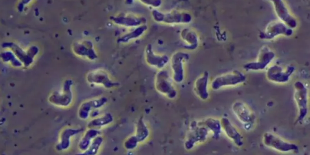 Central NC teen critically ill with rare amoeba infection