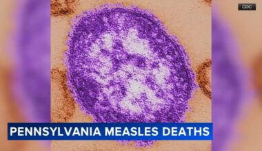 2 unvaccinated people die from measles in Lancaster County, Pennsylvania