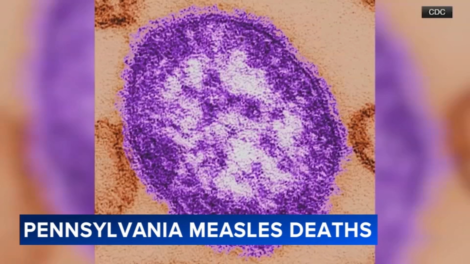 2 unvaccinated people die from measles in Lancaster County, Pennsylvania