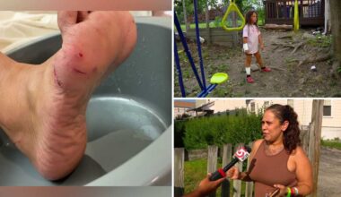 6-year-old girl, woman, bit by fox in Worcester, officials say