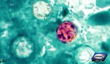 Cyclosporiasis cases continue to rise in NH