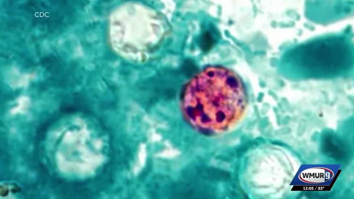 Cyclosporiasis cases continue to rise in NH