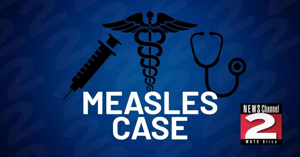 Measles Case Confirmed in Madison County | Health