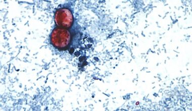 Cyclospora Outbreak