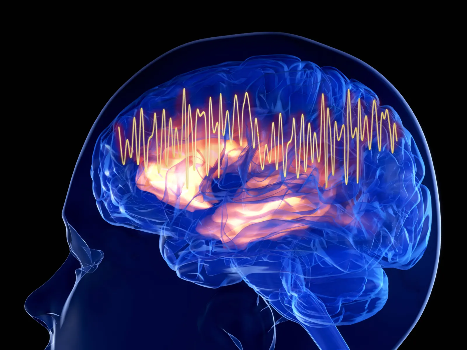 Gamma waves shown in a brain.