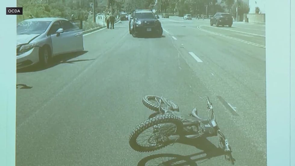 The child went airborne and slammed onto the cement, fracturing his skull and breaking his leg.
