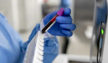 What men need to know about PSA screening for prostate cancer