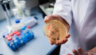 Drug-resistant 'superbug' spreading across US has hit NJ