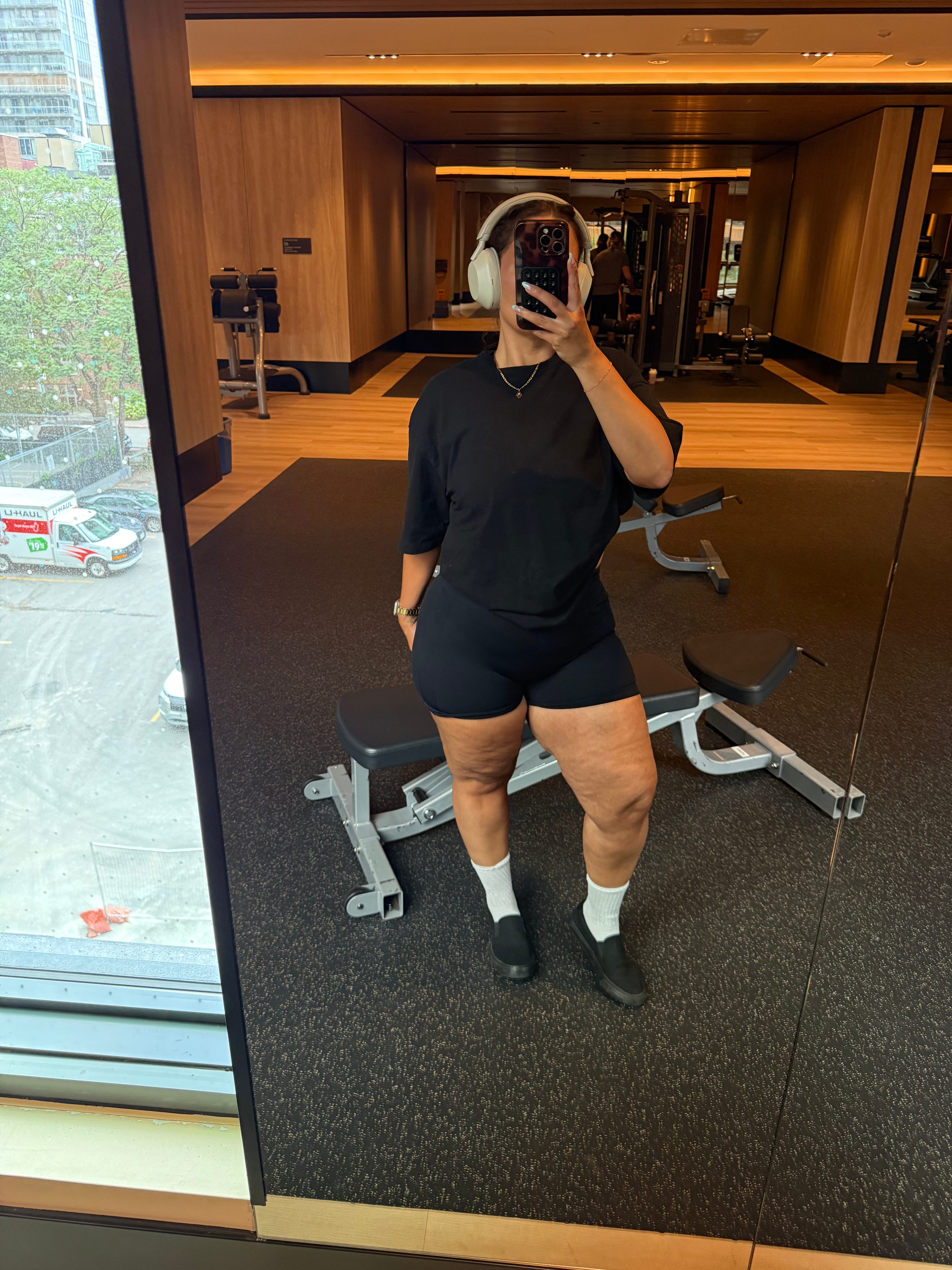 Soraya Nodrab said she stayed active growing up, but never saw changes in her legs. She was later diagnosed with lipedema.