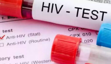 HIV studies reveal promising treatment options