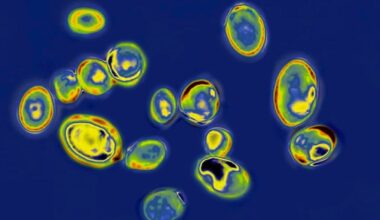 13 cases of new fungus in WA