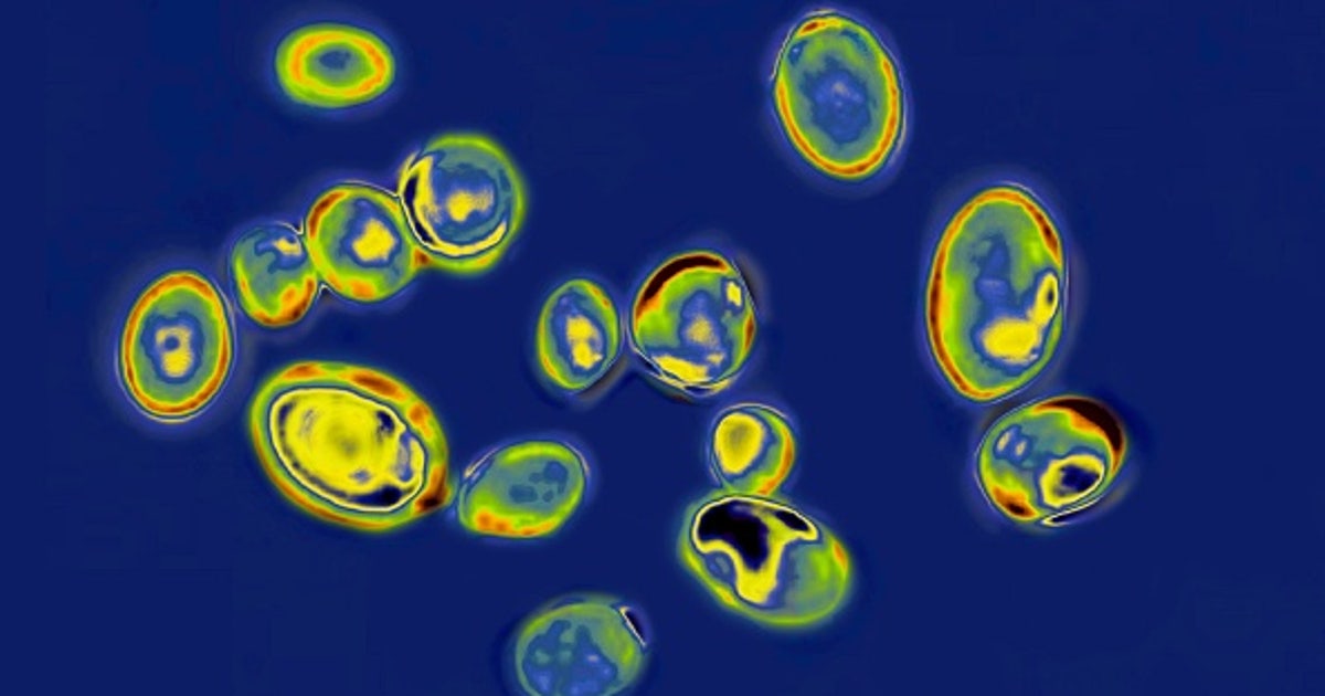13 cases of new fungus in WA