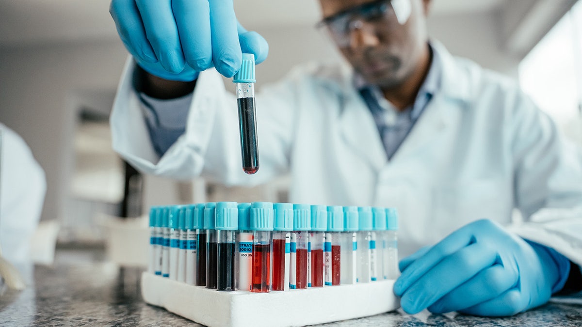 scientist analyzing blood test tubes