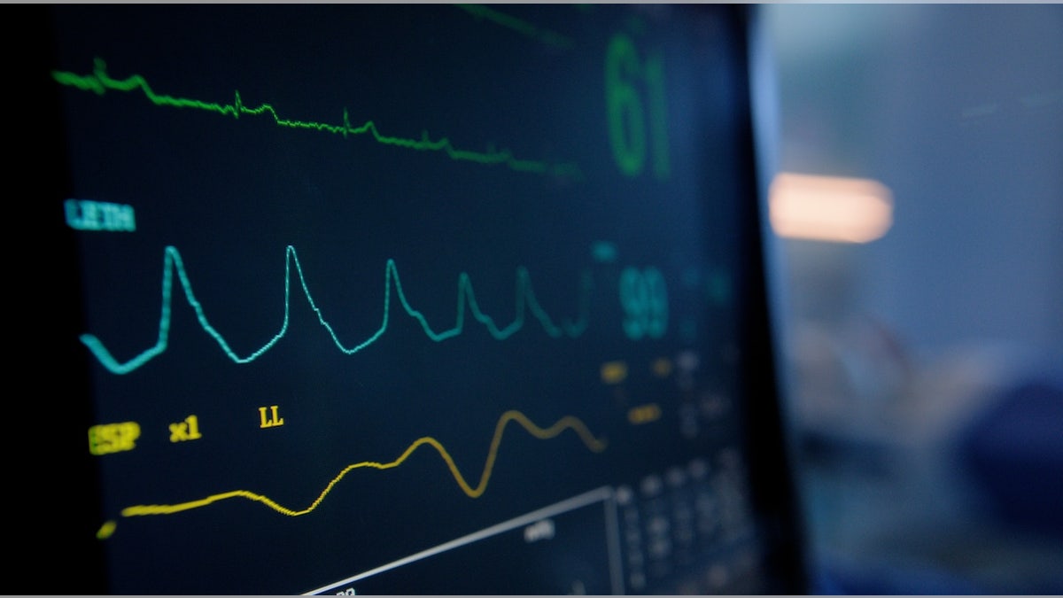 Heart rate monitor