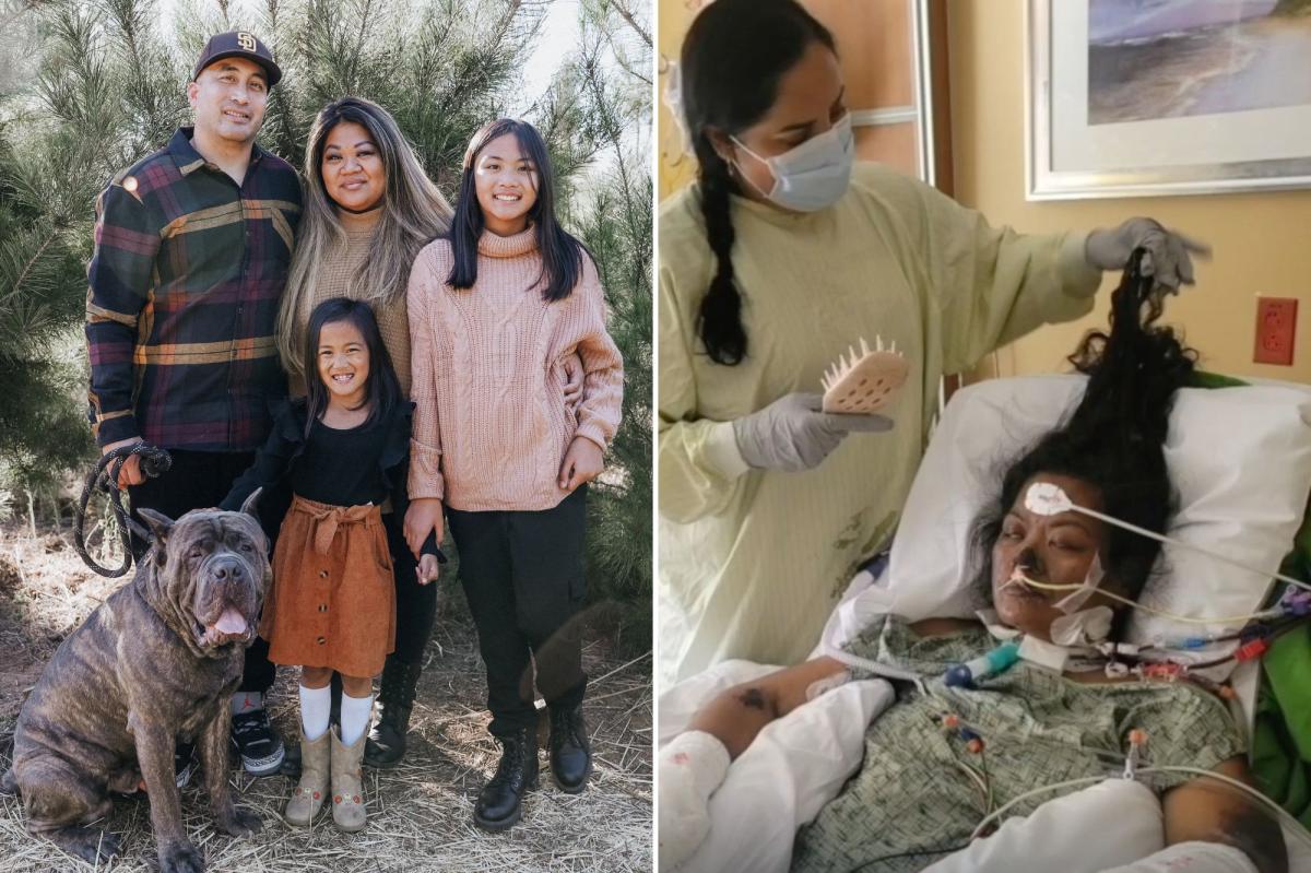 San Diego woman, 41, has arms and legs amputated after routine checkup went horribly wrong