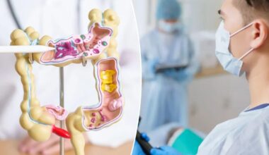 Colon cancer deaths dropped by half for people who did this