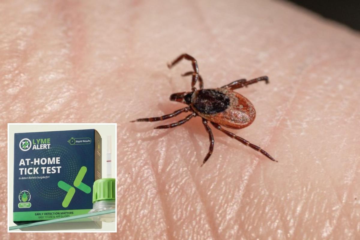 ‘TickCrusher’ kit tests for Lyme disease anxiety in 15 minutes