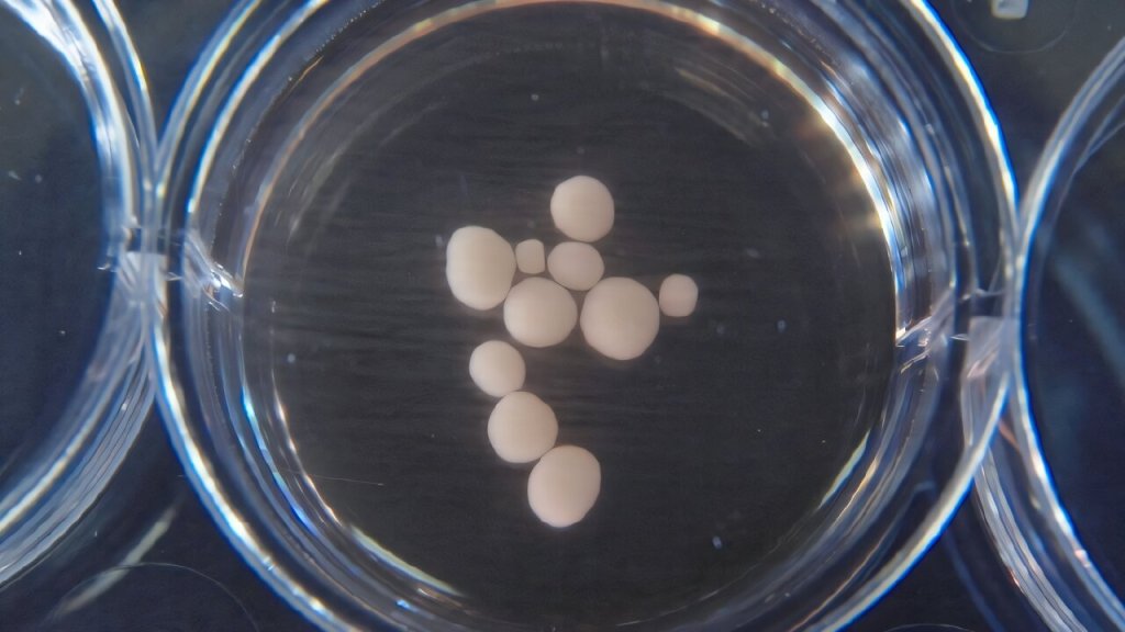 Lab-grown human brain cells in a petri dish.