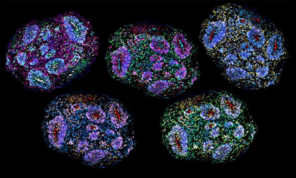 Five brightly colored peppercorn-sized brain organoids on a black background.