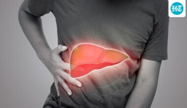 Gastroenterologist Dr Anurag Shetty shares early and advanced symptoms of liver diseases that should not be ignored