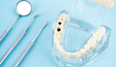 Liquid Fluoride Can Stop Cavities Without Drilling, Major Trial Finds