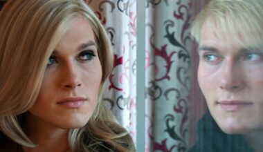 Adolescents report low regret and high satisfaction following gender-affirming chest surgery
