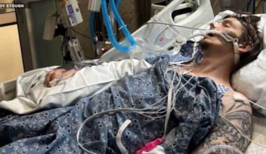 Local man 'lucky to be standing here' after surviving flesh-eating bacteria