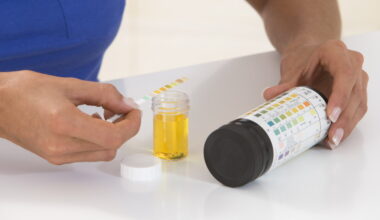 Recurrent UTIs? It may not be an infection—and antibiotics may not help : NPR