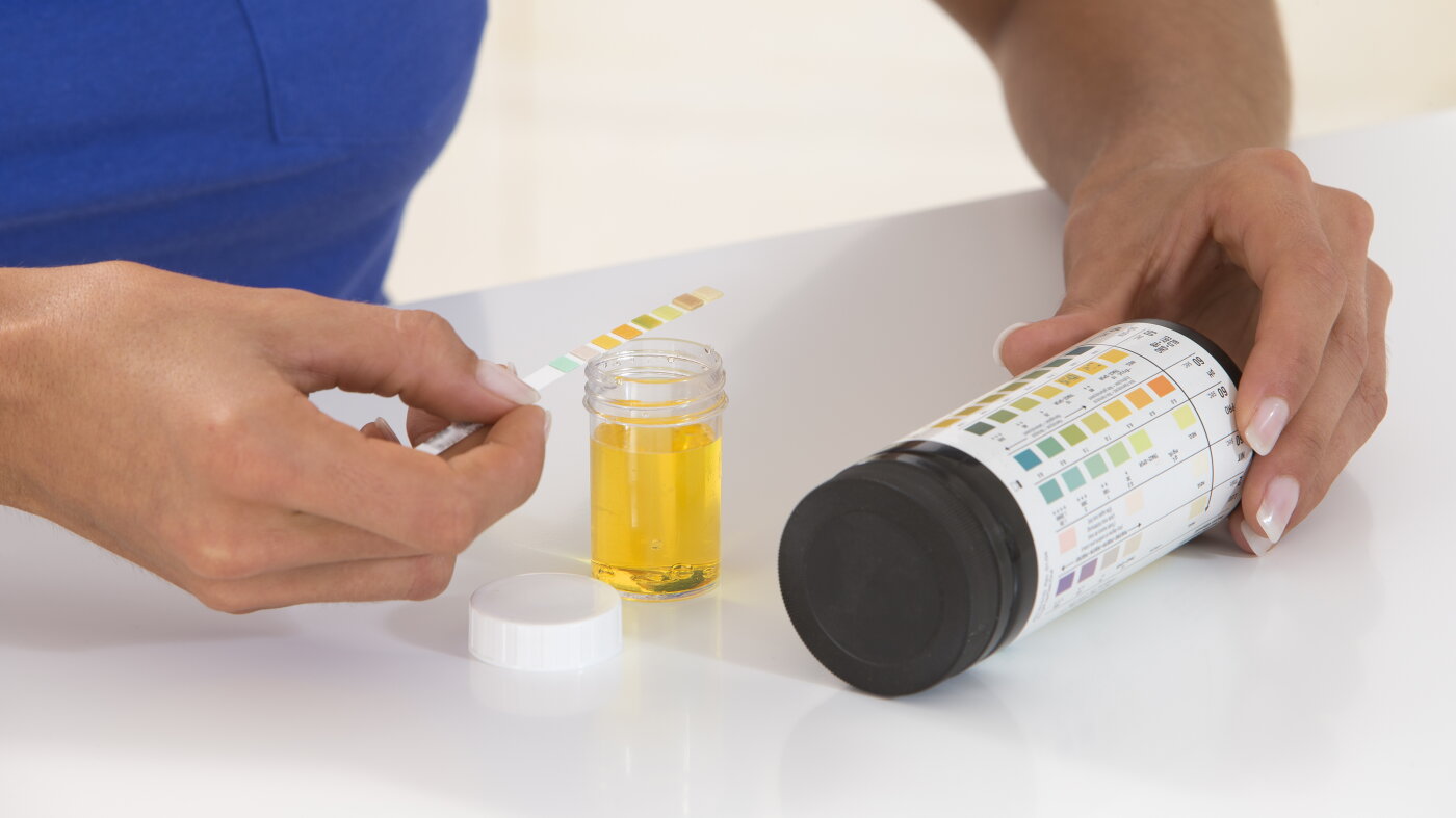 Recurrent UTIs? It may not be an infection—and antibiotics may not help : NPR