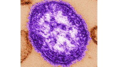 Pennsylvania reports first 2 US measles deaths in 2026