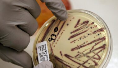 Alfalfa sprouts linked to food poisoning illnesses in these states