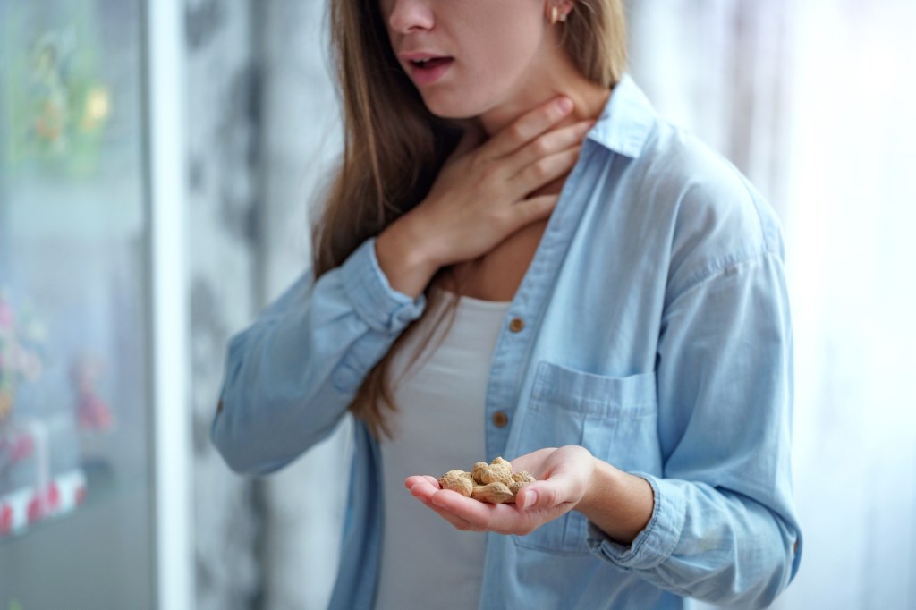 A woman chokes from a peanut allergy.