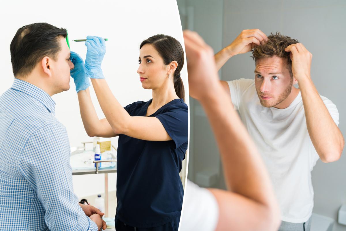 I’m a dermatologist — the top 10 things I tell balding patients
