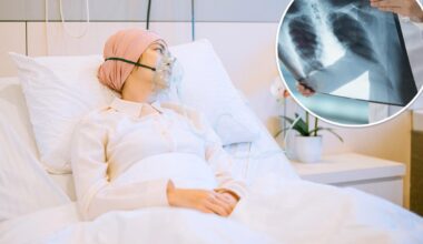 An unlucky trait can increase your lung cancer risk by 62 times