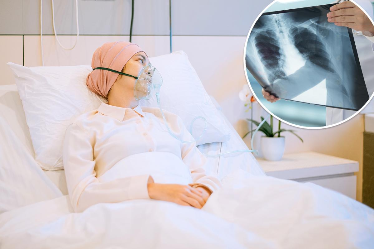 An unlucky trait can increase your lung cancer risk by 62 times