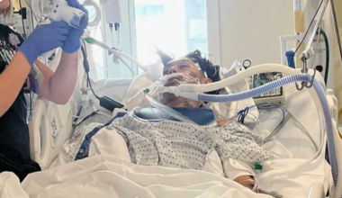 Brain-eating amoeba kills North Carolina teen in rare infection