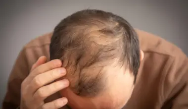 Ozempic and Wegovy may raise hair loss risk in some men
