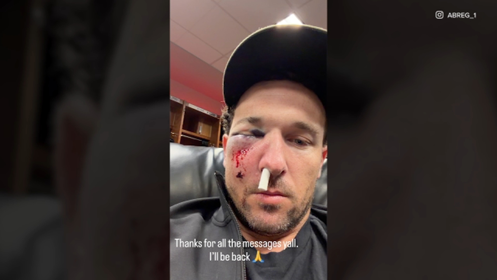 Cubs' Alex Bregman undergoing tests after being hit in face by foul ball at Cincinnati Reds game Sunday