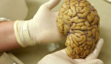 Scientists map gene activity in brain's prefrontal cortex