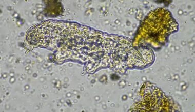 NC teen dead after contracting rare brain-eating amoeba found in freshwater health officials confirm