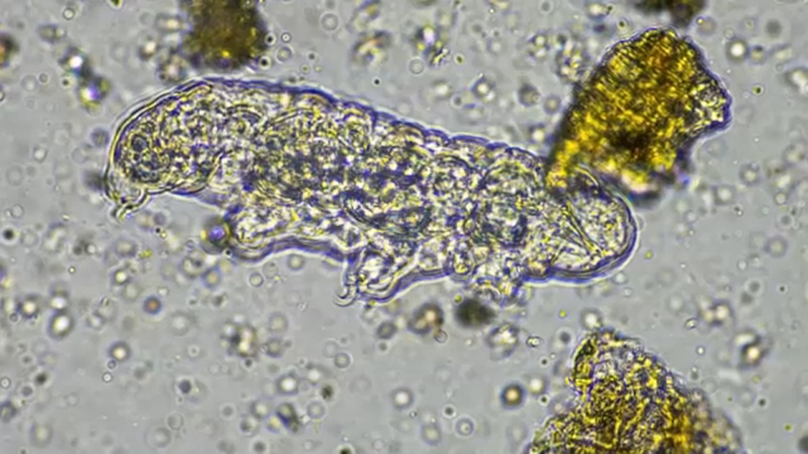 NC teen dead after contracting rare brain-eating amoeba found in freshwater health officials confirm