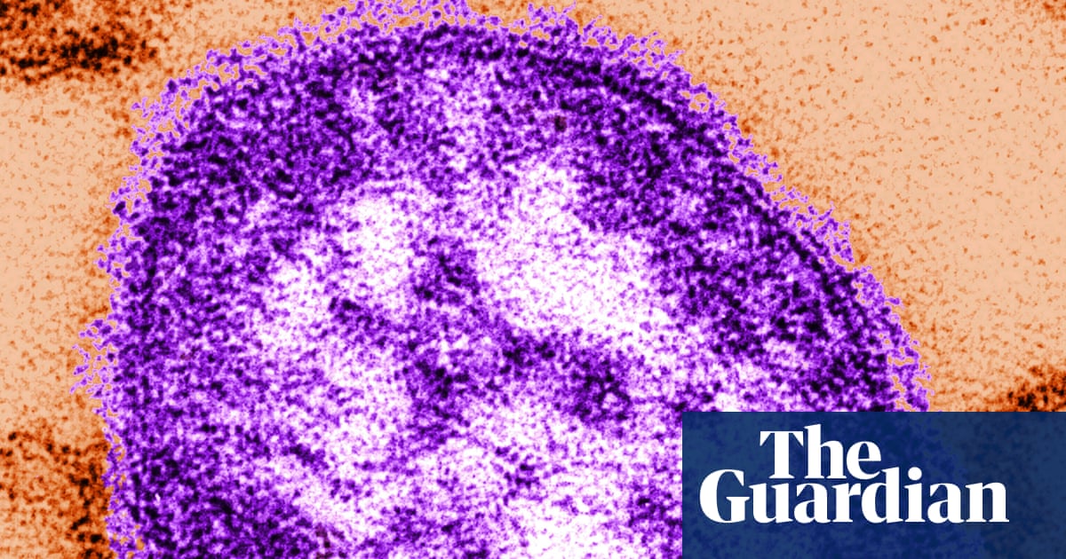 Six-week-old child in Pennsylvania dies from measles, coroner says | Pennsylvania