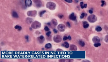 Brain-eating amoeba, flesh-eating bacteria: What NC swimmers should know this Labor Day :: WRAL.com
