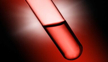 FDA approves new Alzheimer’s blood test that family doctors can order