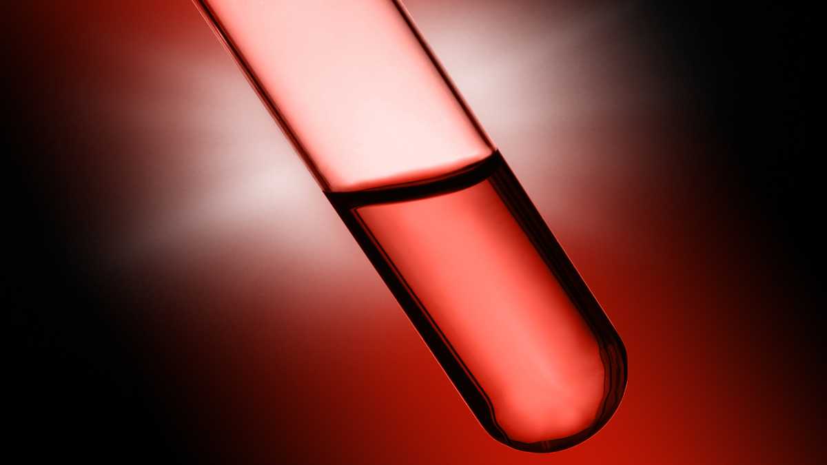 FDA approves new Alzheimer’s blood test that family doctors can order