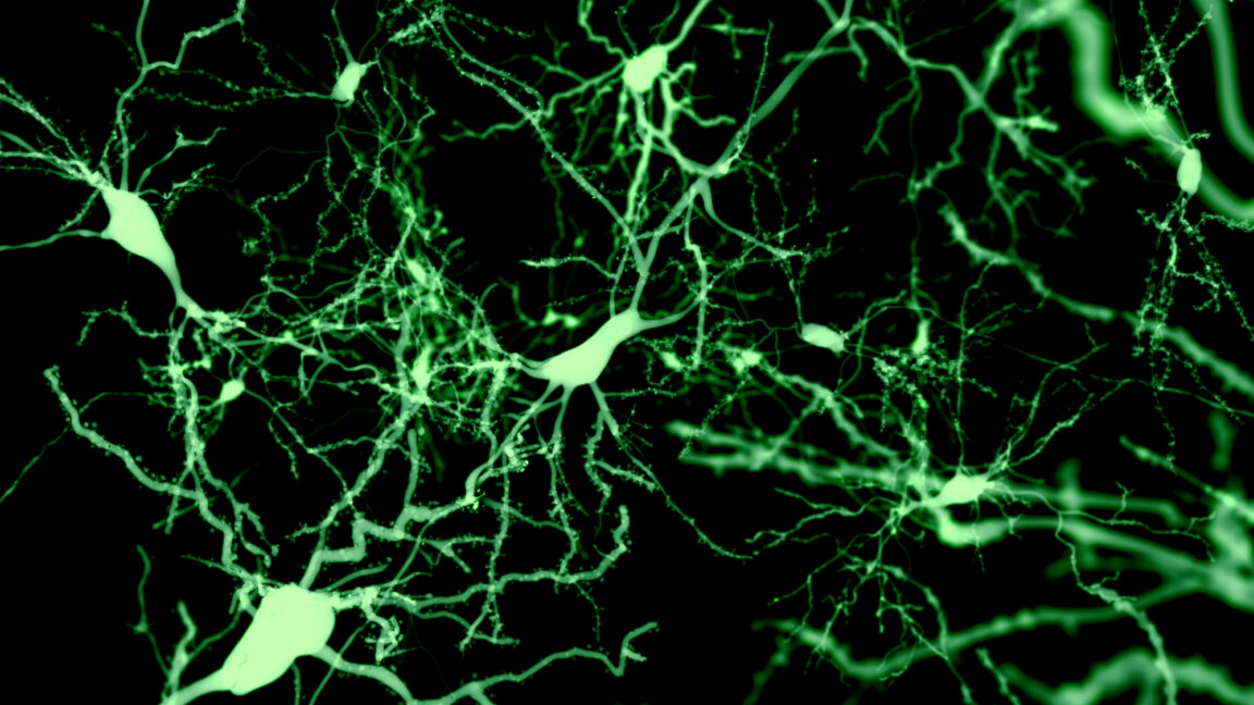 Black background with green fluorescent nerve cells.
