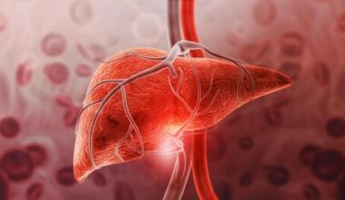Keto diet cuts liver fat by 67% and improves blood sugar, study finds