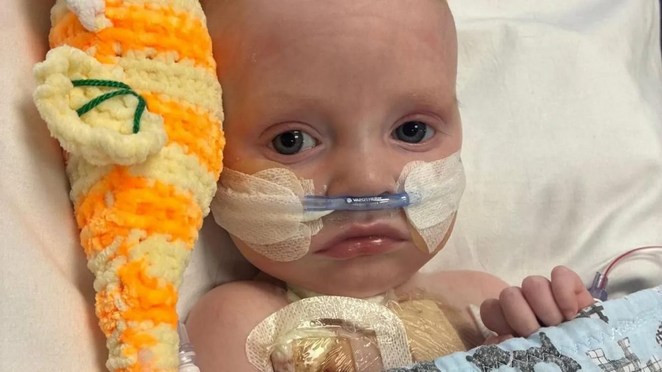 Fitted with a Berlin Heart, Little Macs Is 'Absolutely Thriving' While He Waits for a Heart Transplant